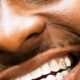 Davido's New Tooth Braces Look Flawless. (See photos.)